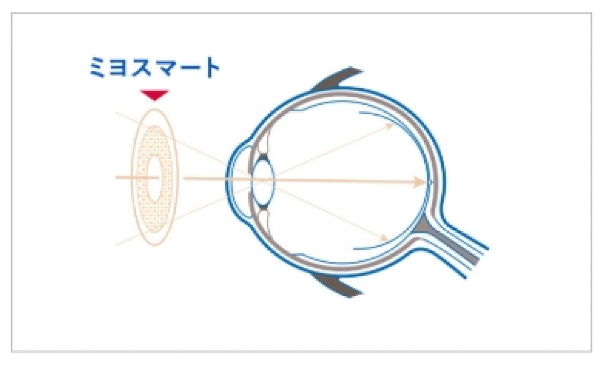 近視抑制眼鏡のご紹介